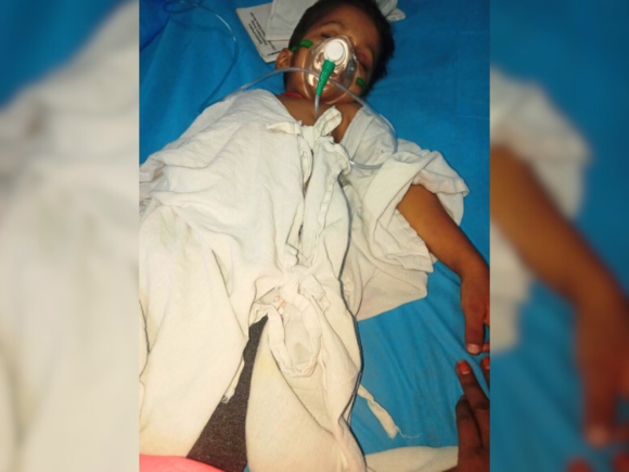 Help Save 3-Year-Old Gaurav from Eye Cancer